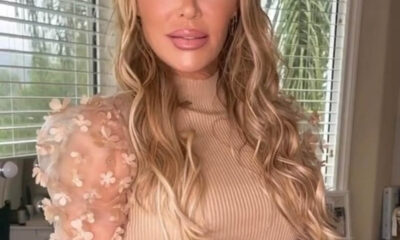 CELEBRITYMiserable’ Brandi Glanville blames Bravo for severe facial swelling: ‘Stress will kill you’