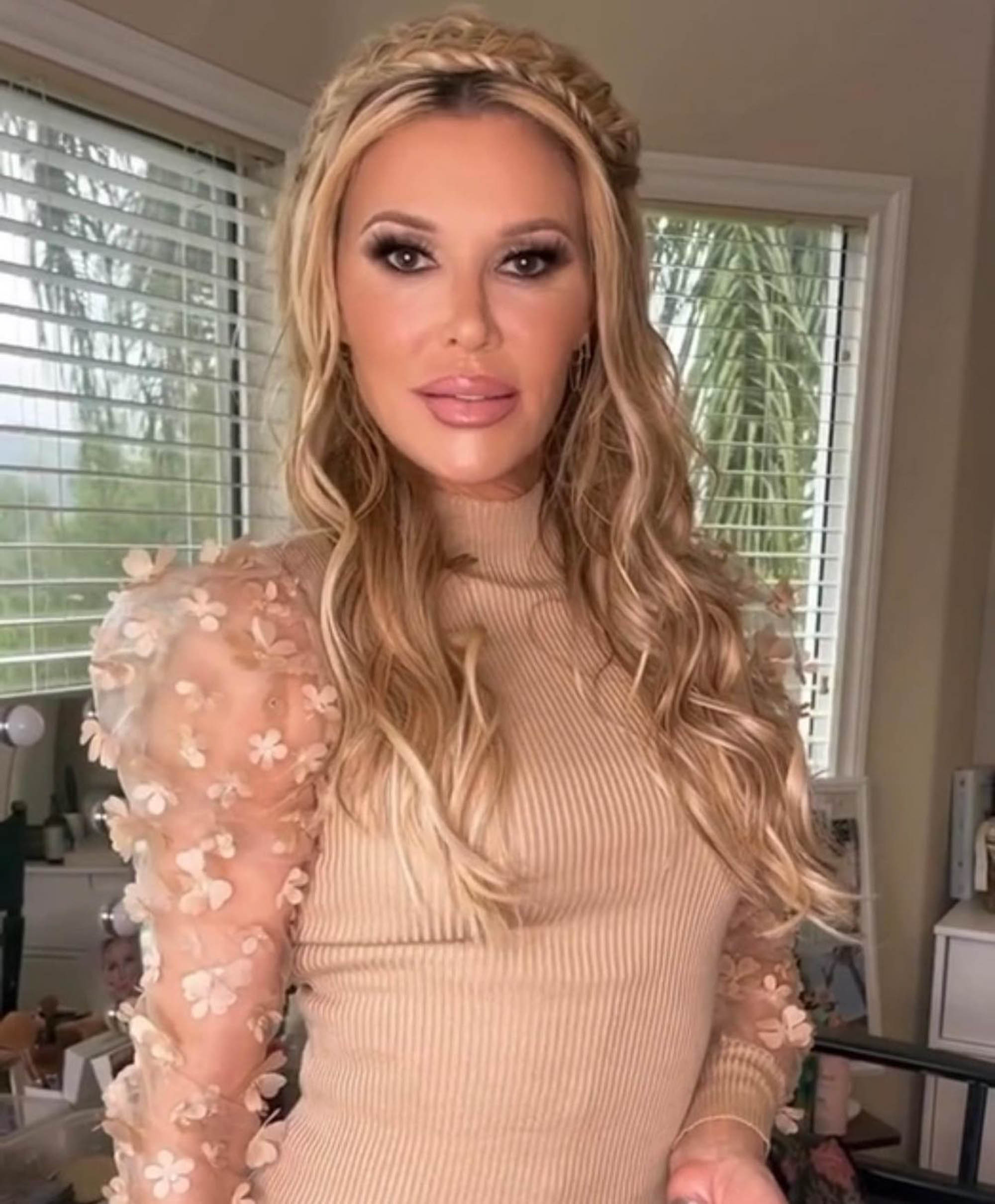 CELEBRITYMiserable’ Brandi Glanville blames Bravo for severe facial swelling: ‘Stress will kill you’